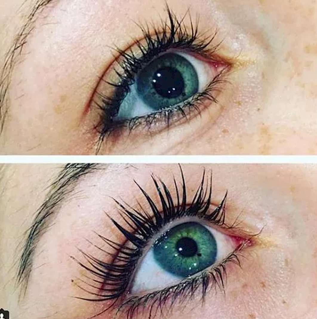 lilash before and after