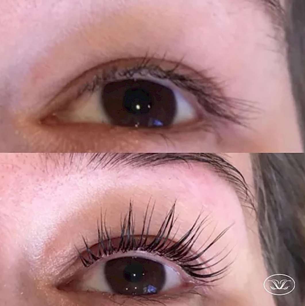 lilash before and after